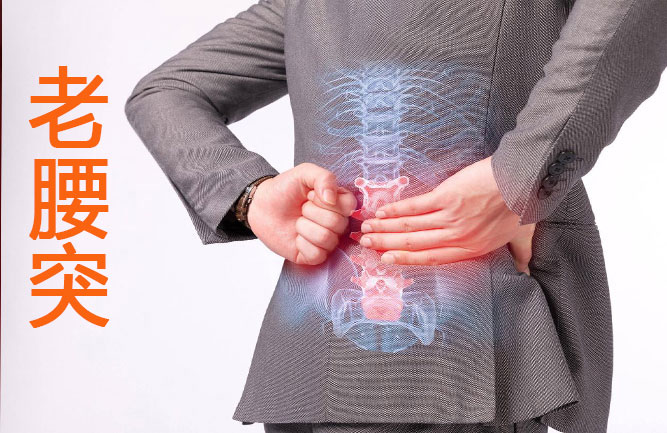 腰椎間盤突出最好的治療方法 腰椎間盤突出最好的治療方法